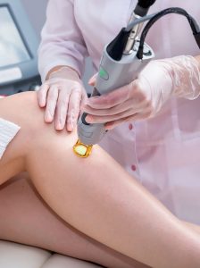 séance d'épilation laser sur une jambe