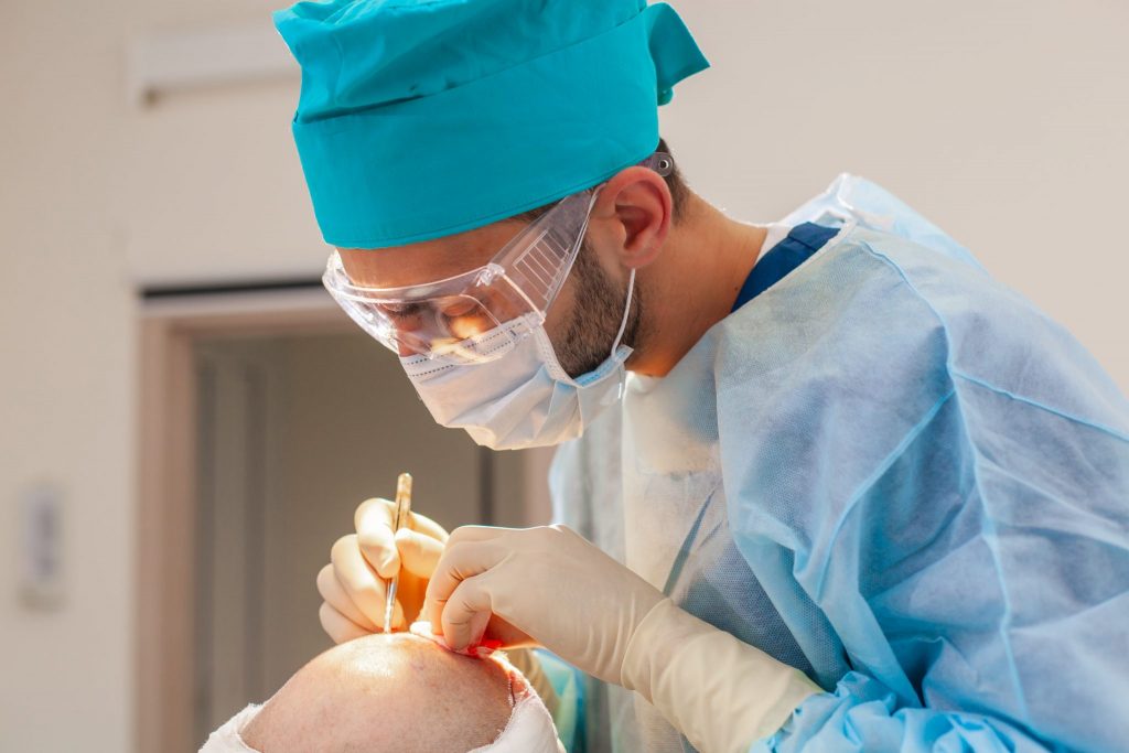 chirurgien pratiquant une greffe de cheveux