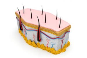 Épilation laser des poils