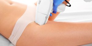 epilation-definitive-laser-maillot-Paris