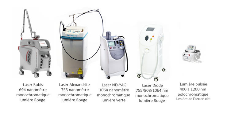 avantages de l'épilation laser