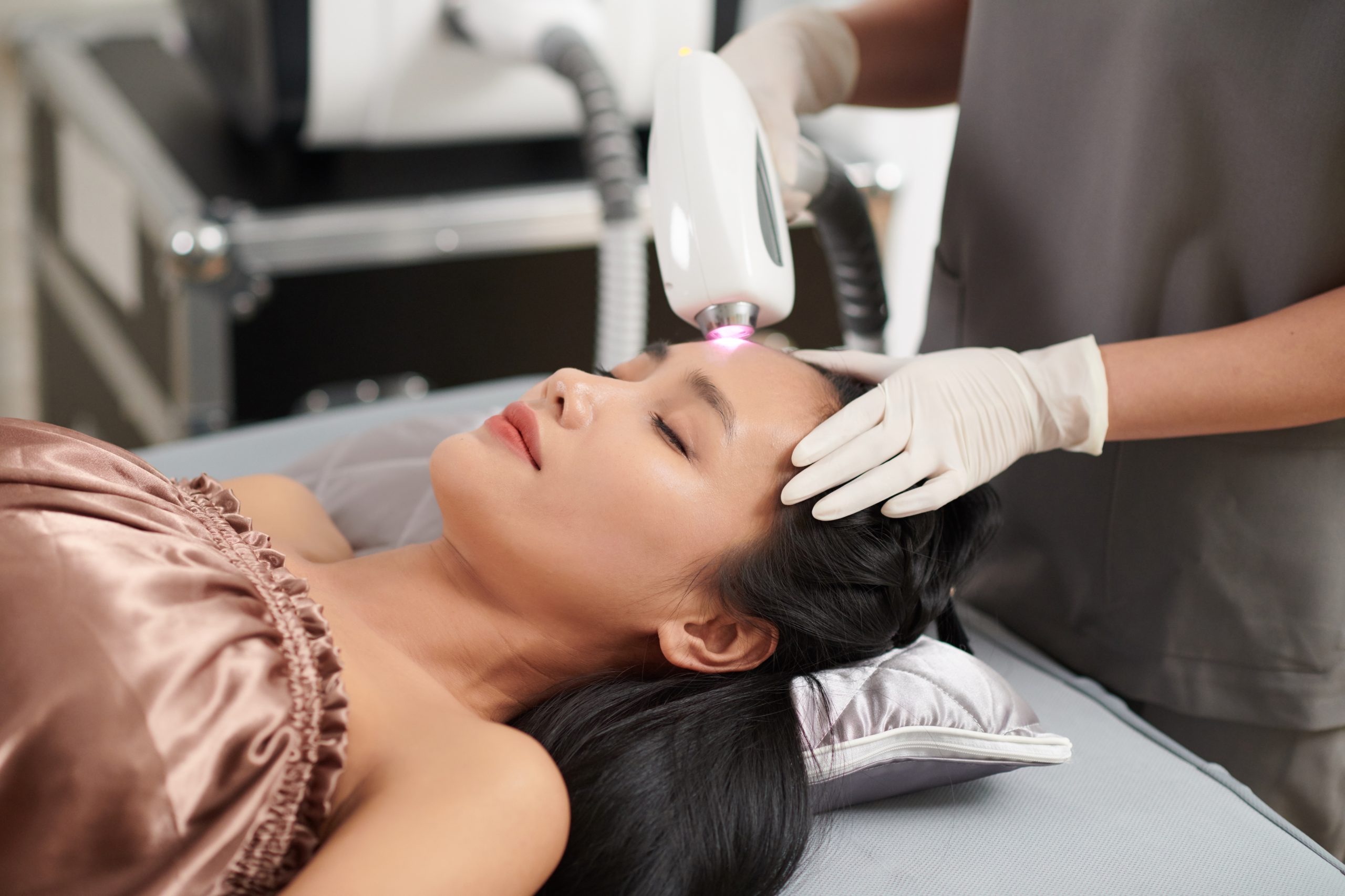 Epilation définitive visage Paris