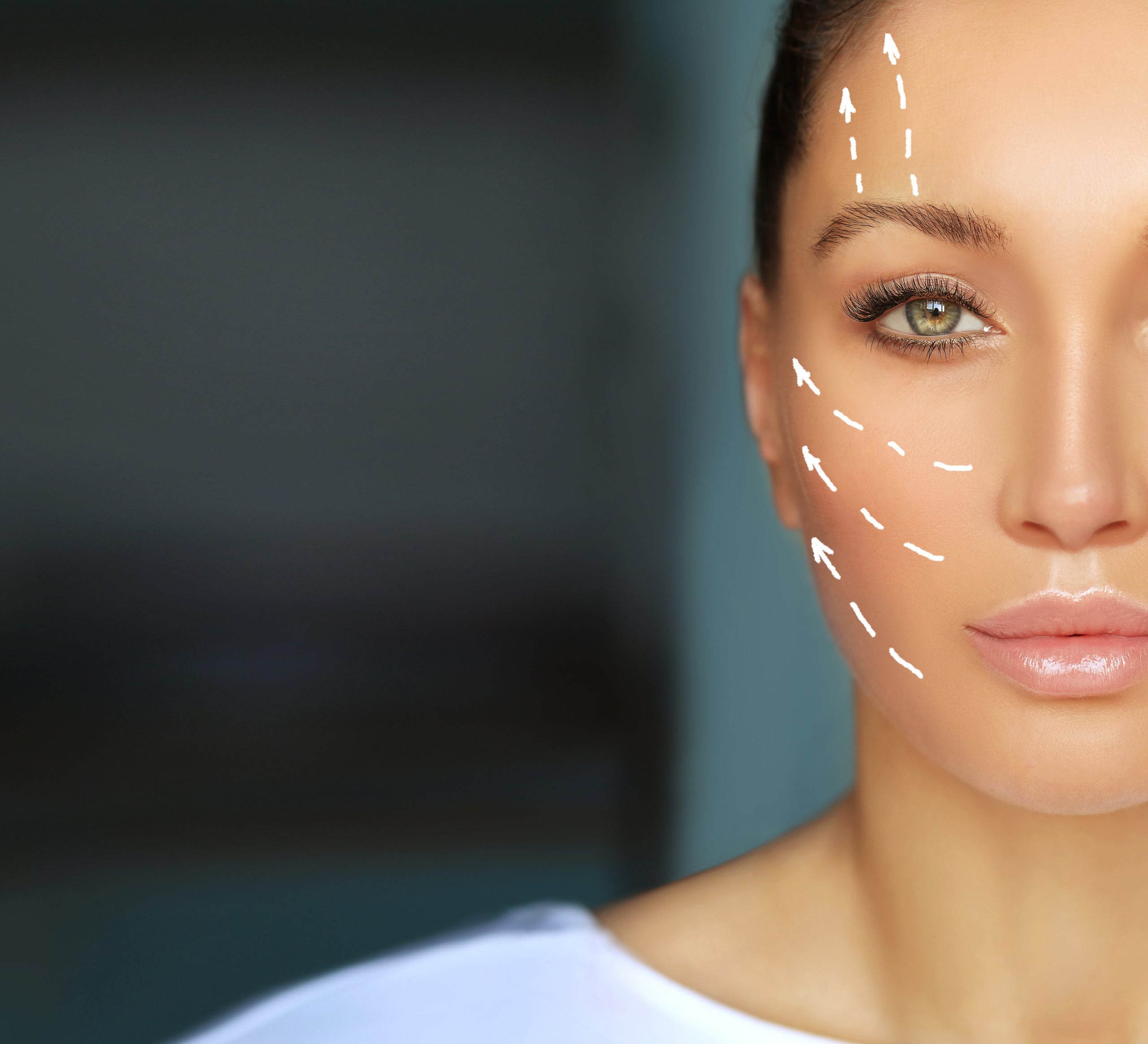 Injections acide hyaluronique Paris tarif