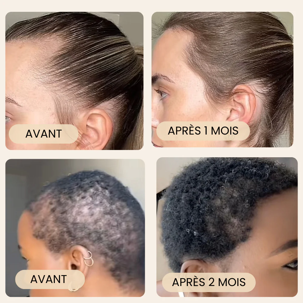 Avantages shampoing anti-chute