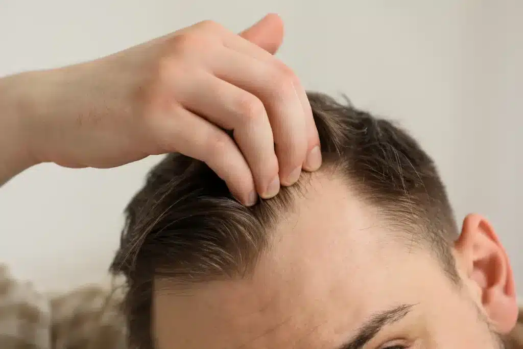 Causes-invisibles-chute-de-cheveux