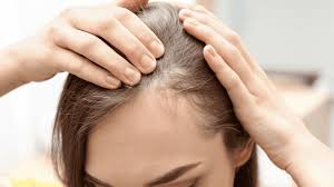 Chute-de-cheveux-stabilisee