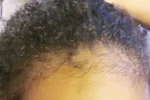 Cheveu-afro