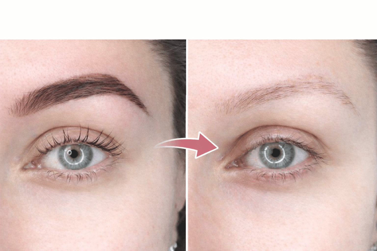 Détatouage sourcils - Spécialité Maison Marignan