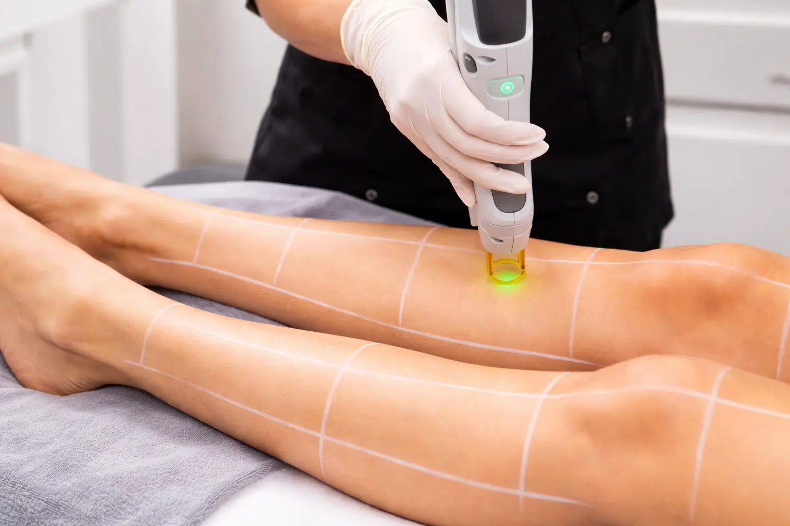 Épilation laser à Paris - Maison Marignan