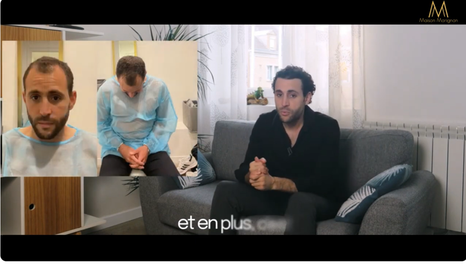 Mehdi — Résultat avant et après greffe de cheveux CHOI à la Maison Marignan Paris