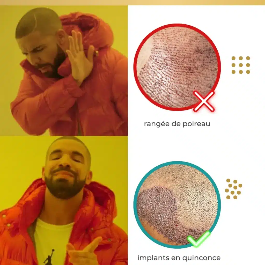 Comparaison rangée de poireau vs implantation en quinconce